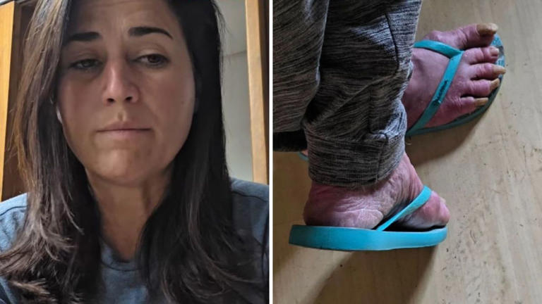 Ex-atriz global Rejane Schumann é encontrada em situação precária; ativista pede ajuda