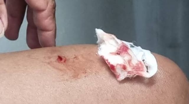 Mulher de 62 anos é atacada por macaco-prego em parque