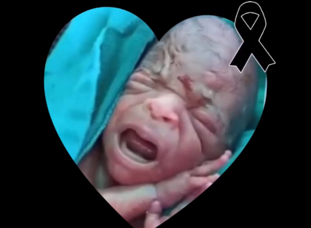 Criança que comoveu o país morre após luta pela vida